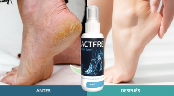 BactFree spray República Dominicana - Precio cuánto cuesta Opiniones cómo se usa