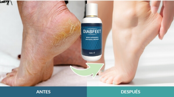 Diabfeet Precio en la República Dominicana - Dónde comprar