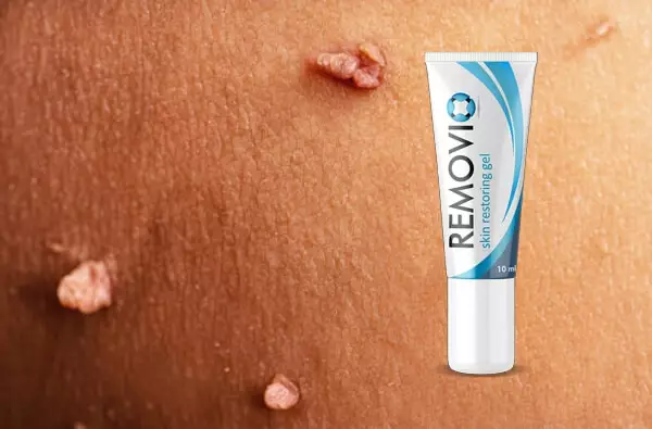 ¿Qué es el gel Removio?