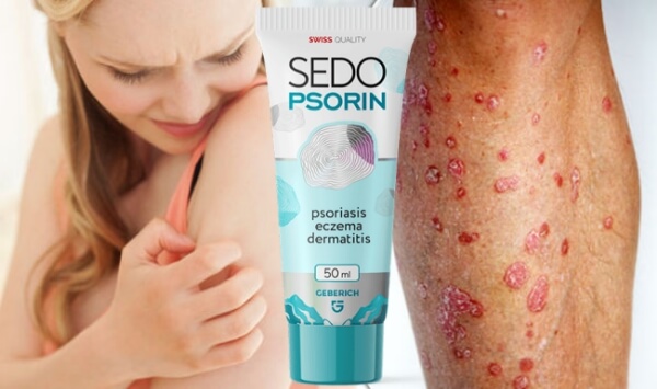 SedoPsorin Crema España - Precio cuánto cuesta Opiniones cómo se usa