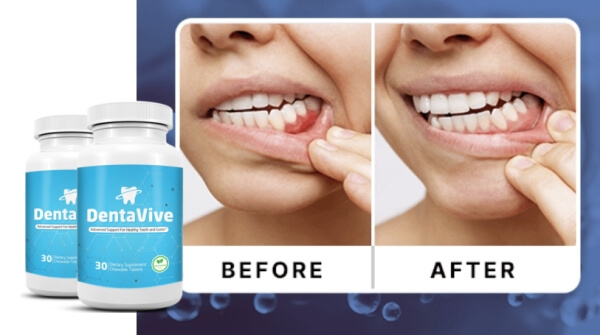 Cómo se usa Dentavive Cómo se usa Dentavive