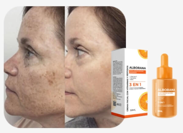 ¿Qué es Alborana y para qué sirve? ¿Qué es Alborana y para qué sirve?