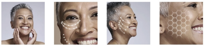 Cómo se usa Lumera: instrucciones de uso